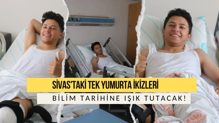 Sivas'taki Tek Yumurta İkizleri Bilim Tarihine Işık Tutacak!