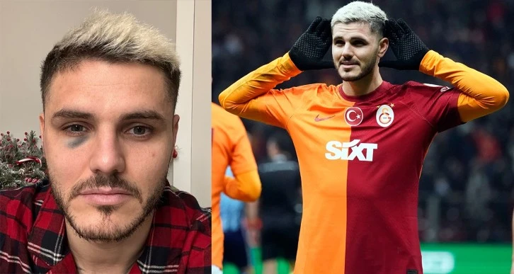 Galatasaray'da Icardi Şoku!