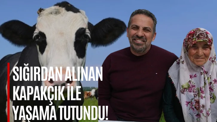 Sığırdan Alınan Kapakçık ile Yaşama Tutundu! 