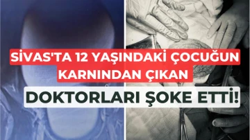 Sivas'ta 12 Yaşındaki Çocuğun Karnından Çıkan Doktorları Şoke Etti!