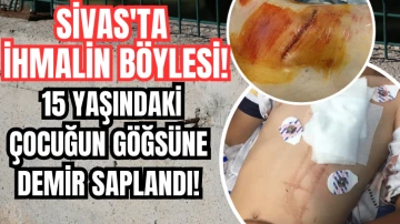 Sivas'ta İhmalin Böylesi! 15 Yaşındaki Çocuğun Göğsüne Demir Saplandı! 